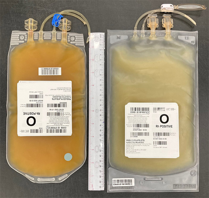 Two yellow bags of Frozen untreated pooled platelets in plasma