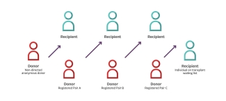 kidney donor domino effect 