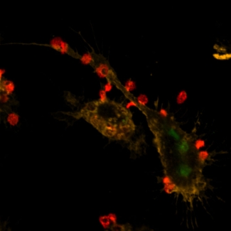 The macrophage in the presence of the control antibody (figure 1) ingested or engulfed more red blood cells (green) than the macrophage treated with the anti-CD44 antibodies (figure 2).