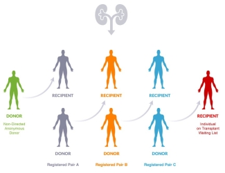 Kidney Paired Donation - how it works