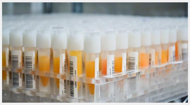 Thumbnail image of many vials of plasma