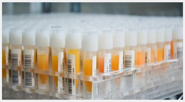 Thumbnail image of many vials of plasma